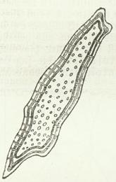 Tüpfelzelle. Tüpfelzelle.